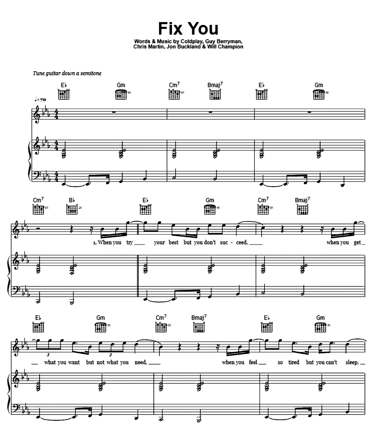 Fix You sheet music